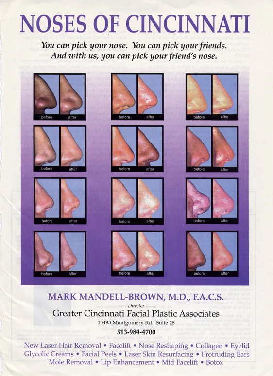 Noses Of Cincinnati advertisement featuring various before and after images