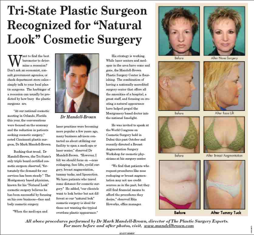 Tri-State Plastic Surgeon Recognized for “Natural Look” Cosmetic Surgery Article Cover