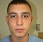 Rhinoplasty