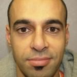 Rhinoplasty