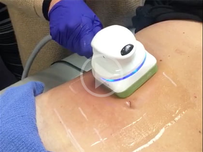 Operating Room Video