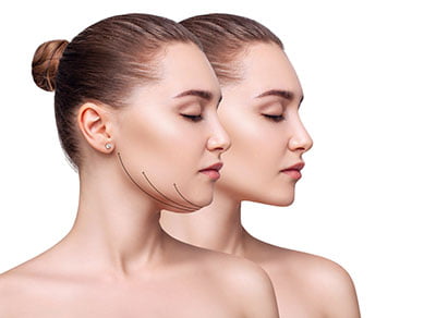 Beautiful woman before and after fat chin correction