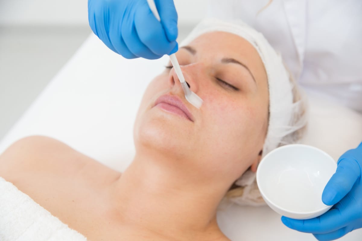 Chemical Peels: What to Do Before and Avoid After